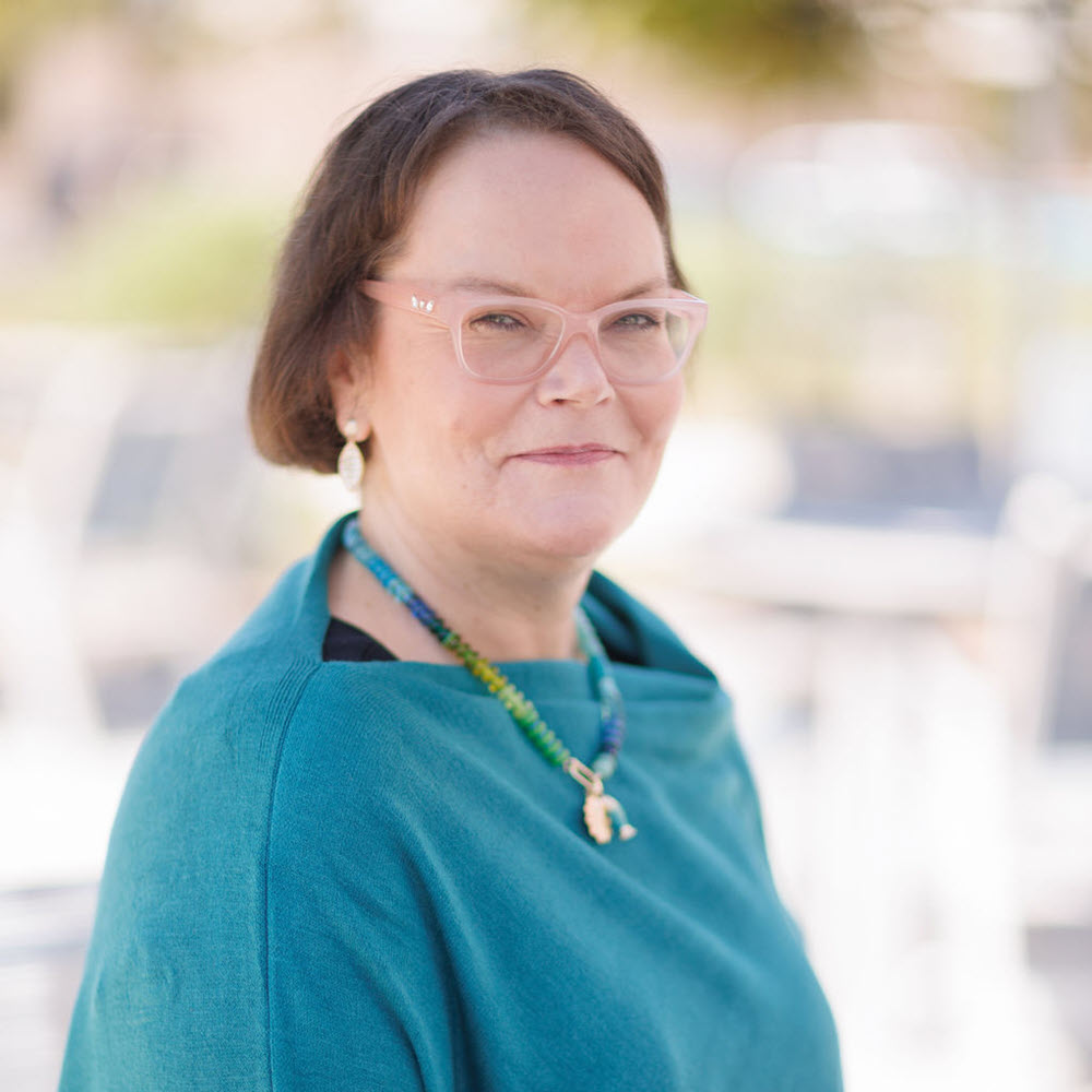 Traci Acromegaly